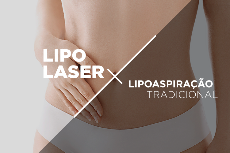 Lipolaser x Lipoaspiração Tradicional